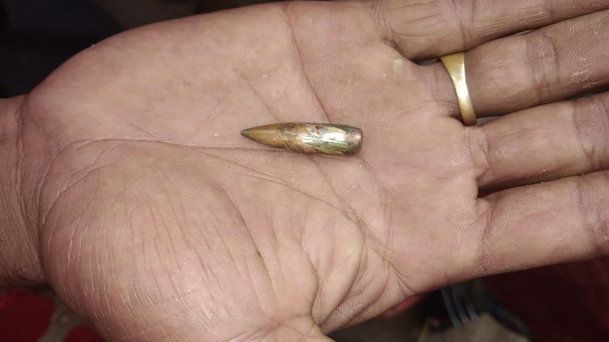 টেকনাফে বাড়ির উঠানে খেলার সময় মিয়ানমার সীমান্ত থেকে ছোড়া গুলিতে এক শিশু মাথায় গুলিবিদ্ধ